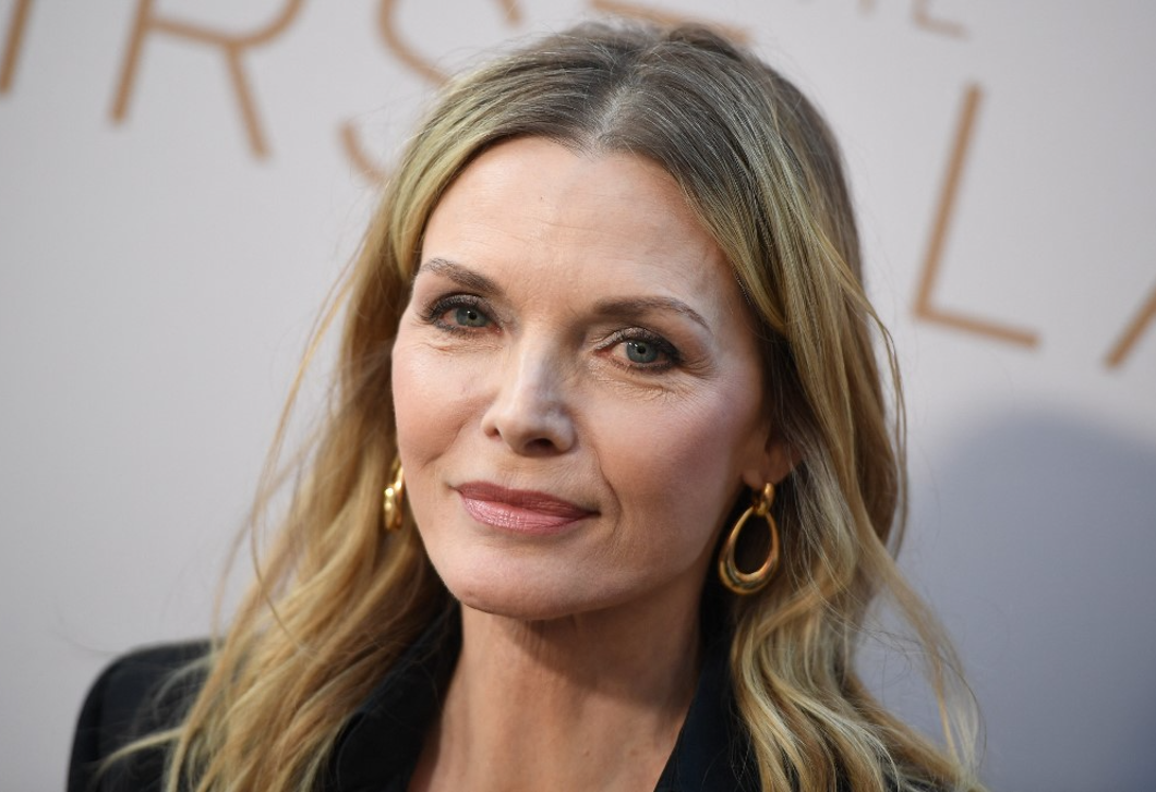 Michelle Pfeiffer komoly sérülést szenvedett - a monoklija a rajongókat is megijesztette