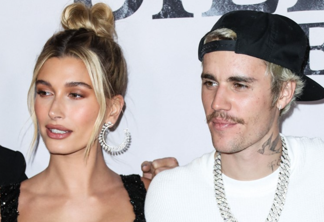 A sárga visszatért – ezúttal Justin és Hailey Bieber otthonában bukkant fel