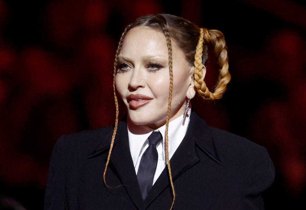Madonna elég furcsa magyarázatot adott arra, miért volt más az arca a Grammyn