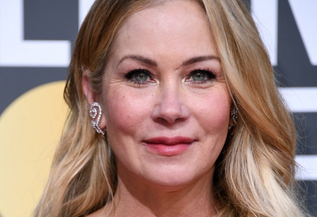 Anorexiájáról vallott Christina Applegate: „Azt akartam, hogy kilátszódjanak a csontjaim”