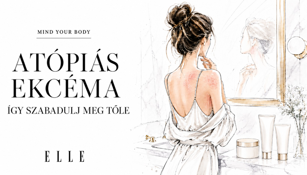 Mit érdemes tudni az atópiás ekcémáról? – megtudhatod az új MIND YOUR BODY Podcast adásából