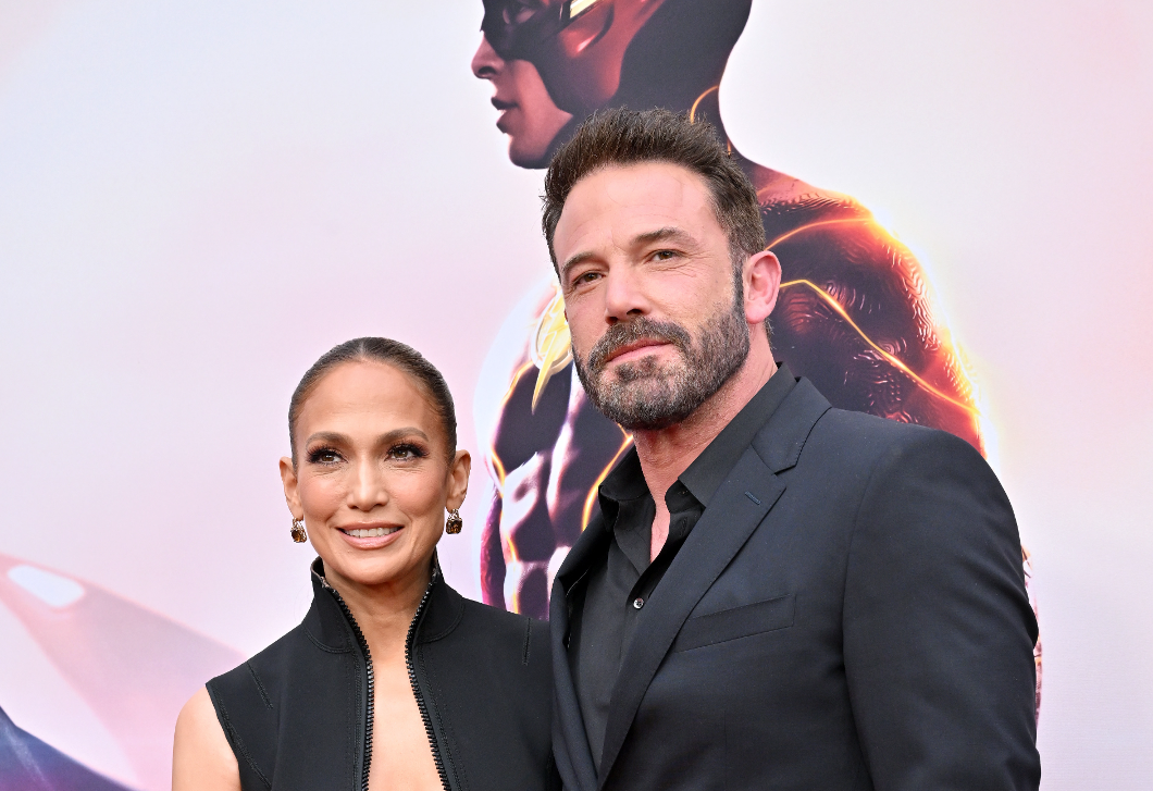 Botrány: Ben Affleck Jennifer Lopez miatt vállalta be a botoxot, kiakadtak a rajongók