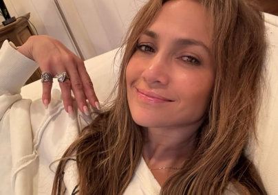 A bőrgyógyász felfedte: ez Jennifer Lopez fiatalos megjelenésének a titka