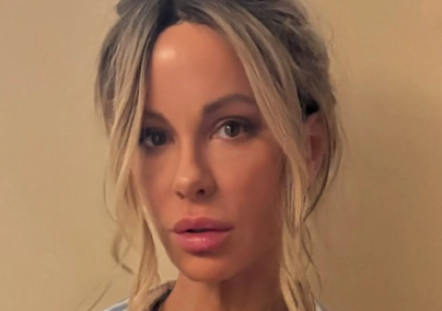 Kate Beckinsale 51 évesen is ragyog: ez a hibátlan bőrének a titka