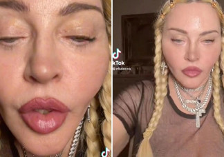 Madonna ijesztő videót posztolt magáról, saját rajongói is kiborultak