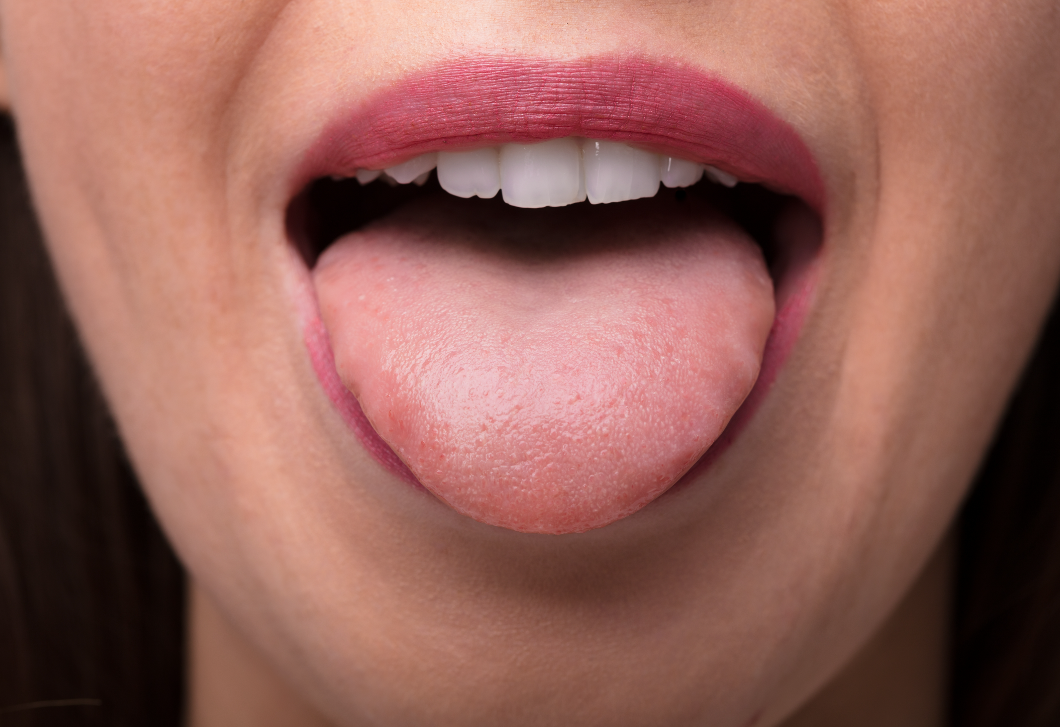 A nyelvrák 4 tünete, ami azonnali kezelést igényel