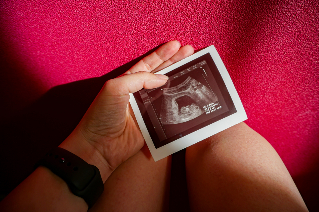 Örülhet-e egy nő a terhességnek a vetélés után?